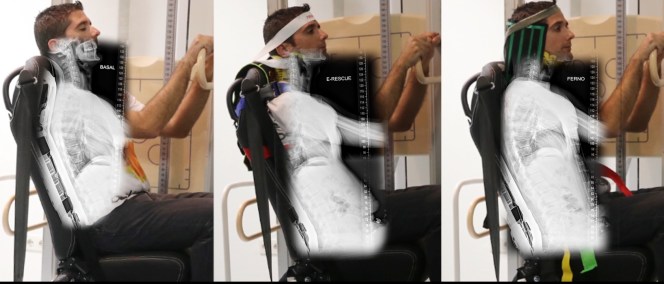 Imagen 2 - estudio radiologico