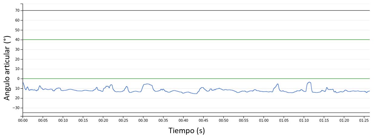 Columna cervical-Flexión-Extensión
